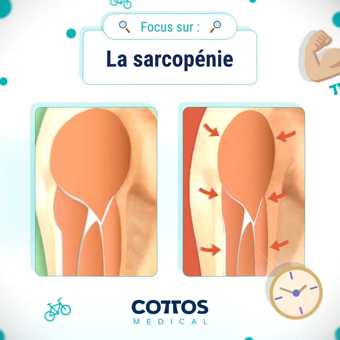 Social post — sarcopenia